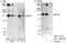 Insulin Receptor Substrate 1 antibody, A301-158A, Bethyl Labs, Immunoprecipitation image 