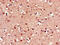 Frizzled Class Receptor 8 antibody, CSB-PA880970LA01HU, Cusabio, Immunohistochemistry paraffin image 