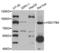 Hydroxysteroid 17-Beta Dehydrogenase 4 antibody, LS-C334544, Lifespan Biosciences, Western Blot image 