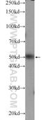 Zinc finger and BTB domain-containing protein 25 antibody, 25631-1-AP, Proteintech Group, Western Blot image 