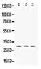 Protein Kinase AMP-Activated Non-Catalytic Subunit Beta 2 antibody, PA5-79866, Invitrogen Antibodies, Western Blot image 