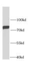 Glycyl-TRNA Synthetase antibody, FNab03347, FineTest, Western Blot image 