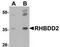 Rhomboid domain-containing protein 2 antibody, TA306891, Origene, Western Blot image 