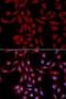 p18 antibody, LS-C748601, Lifespan Biosciences, Immunofluorescence image 