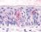 T1r3 antibody, NLS5073, Novus Biologicals, Immunohistochemistry frozen image 