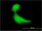DnaJ Heat Shock Protein Family (Hsp40) Member B2 antibody, H00003300-M03, Novus Biologicals, Immunocytochemistry image 
