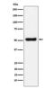 Olfactomedin 4 antibody, M04094, Boster Biological Technology, Western Blot image 