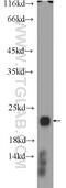 Rac Family Small GTPase 2 antibody, 10735-1-AP, Proteintech Group, Western Blot image 
