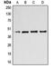 Beta-1,4-Galactosyltransferase 3 antibody, orb214815, Biorbyt, Western Blot image 