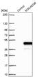 Zinc Finger Protein 843 antibody, PA5-56588, Invitrogen Antibodies, Western Blot image 