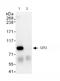Denticleless E3 Ubiquitin Protein Ligase Homolog antibody, ab72264, Abcam, Immunoprecipitation image 