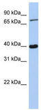 PR/SET Domain 4 antibody, TA331192, Origene, Western Blot image 