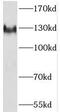 Splicing Factor 3a Subunit 1 antibody, FNab07774, FineTest, Western Blot image 