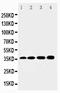 Hydroxysteroid 17-Beta Dehydrogenase 1 antibody, PA1613-1, Boster Biological Technology, Western Blot image 