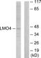 LIM Domain Only 4 antibody, LS-C118961, Lifespan Biosciences, Western Blot image 