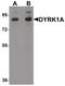 Dual specificity tyrosine-phosphorylation-regulated kinase 1A antibody, PA5-21124, Invitrogen Antibodies, Western Blot image 