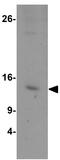 Hypoxia Inducible Lipid Droplet Associated antibody, GTX16280, GeneTex, Western Blot image 