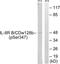 C-X-C Motif Chemokine Receptor 2 antibody, TA311630, Origene, Western Blot image 