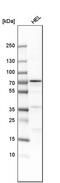 Arachidonate 12-lipoxygenase, 12S-type antibody, PA5-52728, Invitrogen Antibodies, Western Blot image 