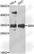KIR antibody, A7433, ABclonal Technology, Western Blot image 