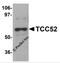 DDB1 And CUL4 Associated Factor 12 antibody, 5703, ProSci, Western Blot image 