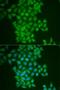 Ferritin Heavy Chain 1 antibody, LS-C331293, Lifespan Biosciences, Immunofluorescence image 
