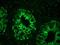 Keratin 18 antibody, NBP1-97715, Novus Biologicals, Immunohistochemistry paraffin image 