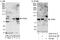 Stromal Interaction Molecule 1 antibody, A303-414A, Bethyl Labs, Immunoprecipitation image 