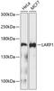 La Ribonucleoprotein Domain Family Member 1 antibody, A04488, Boster Biological Technology, Western Blot image 