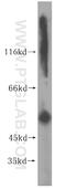 Keratin 6A antibody, 16853-1-AP, Proteintech Group, Western Blot image 