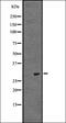 Inhibitor Of Growth Family Member 2 antibody, orb335443, Biorbyt, Western Blot image 