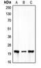 Claudin 7 antibody, orb213770, Biorbyt, Western Blot image 
