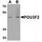 POU Class 3 Homeobox 2 antibody, MBS153400, MyBioSource, Western Blot image 