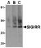 Single Ig And TIR Domain Containing antibody, GTX39096, GeneTex, Western Blot image 