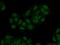 Cleavage Stimulation Factor Subunit 2 Tau Variant antibody, 14206-1-AP, Proteintech Group, Immunofluorescence image 
