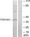 Tyrosine 3-Monooxygenase/Tryptophan 5-Monooxygenase Activation Protein Eta antibody, A04219, Boster Biological Technology, Western Blot image 