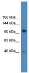 BAF Chromatin Remodeling Complex Subunit BCL11B antibody, TA345503, Origene, Western Blot image 