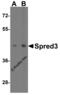 Sprouty Related EVH1 Domain Containing 3 antibody, 4851, ProSci, Western Blot image 