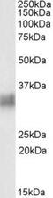 CD317 antibody, TA311291, Origene, Western Blot image 