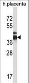 Intelectin 2 antibody, LS-C165335, Lifespan Biosciences, Western Blot image 