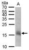 ChaC Cation Transport Regulator Homolog 2 antibody, PA5-78682, Invitrogen Antibodies, Western Blot image 