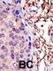 UBE2L3 antibody, abx031524, Abbexa, Immunohistochemistry paraffin image 