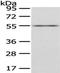 Ecto-apyrase antibody, TA351932, Origene, Western Blot image 