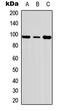 FER Tyrosine Kinase antibody, LS-C358983, Lifespan Biosciences, Western Blot image 