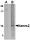 Nanos C2HC-Type Zinc Finger 2 antibody, MBS150734, MyBioSource, Western Blot image 