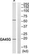 Gal-4 antibody, TA314152, Origene, Western Blot image 