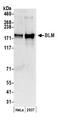BLM RecQ Like Helicase antibody, NB100-324, Novus Biologicals, Western Blot image 