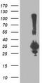 Phenylethanolamine N-Methyltransferase antibody, TA502853, Origene, Western Blot image 