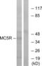 Melanocortin 5 Receptor antibody, abx015341, Abbexa, Western Blot image 