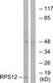 Ribosomal Protein S12 antibody, TA314489, Origene, Western Blot image 